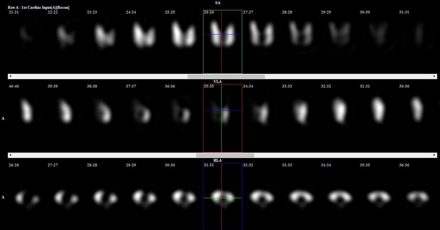 1678248654880758.jpg 甲狀腺.jpg